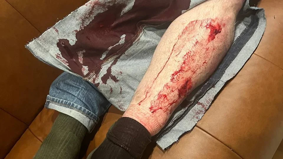 На соратника Навального Леонида Волкова напали у его дома в Вильнюсе